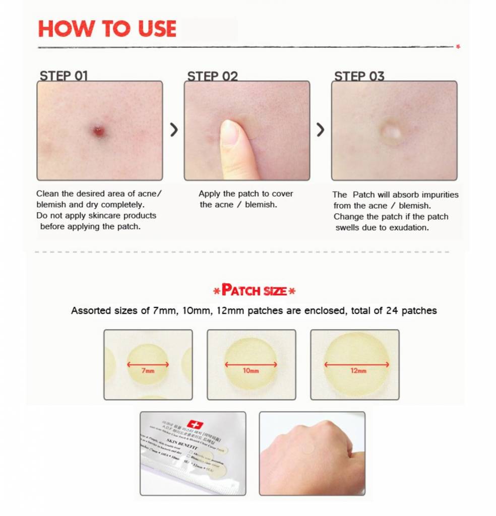 How to use acne patch